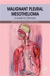 Book cover of Malignant Pleural Mesothelioma by Antonio Giordano