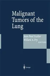 Book cover of Malignant Tumors of the Lung by Unknown