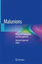 Book cover of Malunions by Animesh Agarwal