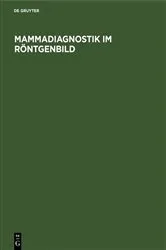 Book cover of Mammadiagnostik im Röntgenbild (2nd ed.) by Unknown
