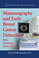 Book cover of Mammography and Early Breast Cancer Detection by Hollingsworth, Alan B., M.D.
