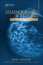 Book cover of Mammography Screening by Peter Gotzsche