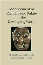 Book cover of Management of Cleft Lip and Palate in the Developing World by Michael Mars
