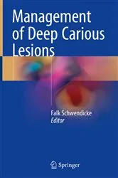 Book cover of Management of Deep Carious Lesions by Falk Schwendicke