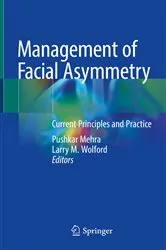 Book cover of Management of Facial Asymmetry by Pushkar Mehra