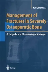 Book cover of Management of Fractures in Severely Osteoporotic Bone by Karl Obrant