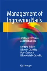 Book cover of Management of Ingrowing Nails by Bertrand Richert