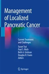 Book cover of Management of Localized Pancreatic Cancer by Susan Tsai