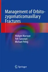 Book cover of Management of Orbito-zygomaticomaxillary Fractures by Hisham Marwan