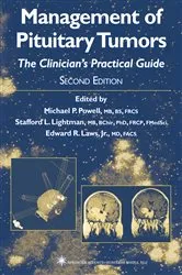 Book cover of Management of Pituitary Tumors by Michael P. Powell