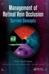 Book cover of Management of Retinal Vein Occlusion by Seenu Hariprasad