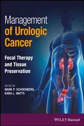 Book cover of Management of Urologic Cancer by Mark P. Schoenberg