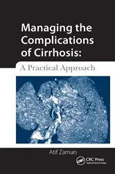 Book cover of Managing the Complications of Cirrhosis by Atif Zaman