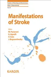 Book cover of Manifestations of Stroke by M. Paciaroni