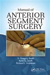 Book cover of Manual of Anterior Segment Surgery by S Gregory Smith