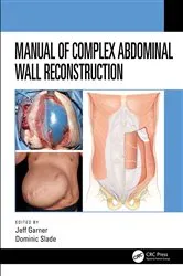 Book cover of Manual of Complex Abdominal Wall Reconstruction by Jeff Garner