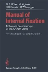 Book cover of Manual of INTERNAL FIXATION (3rd ed.) by Martin AllgÃ¶wer