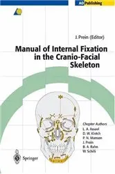 Book cover of Manual of Internal Fixation in the Cranio-Facial Skeleton by Joachim Prein