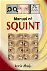 Book cover of Manual of Squint by Leela Ahuja