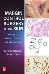 Book cover of Margin Control Surgery of the Skin: Concepts, Histopathology, and Applications by Patrick Emanuel