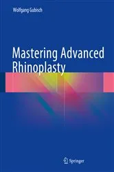 Book cover of Mastering Advanced Rhinoplasty by Wolfgang Gubisch