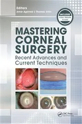 Book cover of Mastering Corneal Surgery by Amar Agarwal