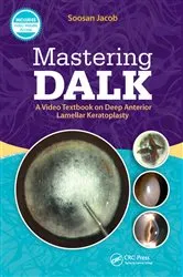 Book cover of Mastering DALK by Soosan Jacob