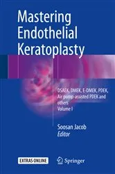 Book cover of Mastering Endothelial Keratoplasty by Soosan Jacob