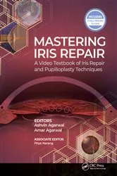 Book cover of Mastering Iris Repair by Ashvin Agarwal