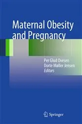 Book cover of Maternal Obesity and Pregnancy by Per Glud Ovesen