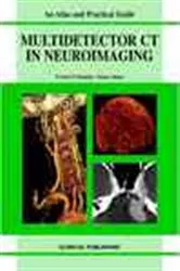 Book cover of MDCT in Neuroimaging by E Teasdale