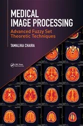 Book cover of Medical Image Processing by Tamalika Chaira