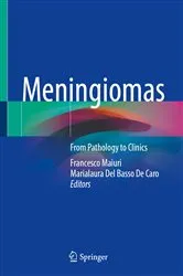 Book cover of Meningiomas by Francesco Maiuri