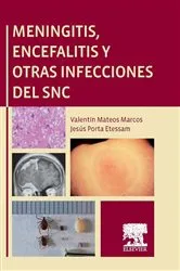 Book cover of Meningitis, encefalitis y otras infecciones del SNC by Valentín Mateos Marcos