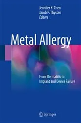 Book cover of Metal Allergy by Jennifer K Chen