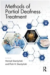 Book cover of Methods of Partial Deafness Treatment by Henryk Skarżyński