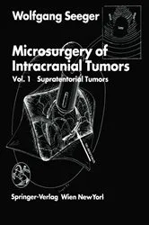 Book cover of Microsurgery of Intracranial Tumors by J.M. Gilsbach
