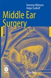 Book cover of Middle Ear Surgery by Henning Hildmann