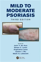 Book cover of Mild to Moderate Psoriasis (3rd ed.) by John Koo