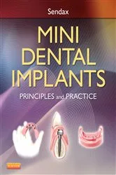 Book cover of Mini Dental Implants by Victor Dr. Sendax