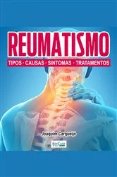 Book cover of Minibook Reumatismo by Unknown