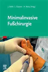 Book cover of Minimalinvasive Fußchirurgie by Jörn Dohle