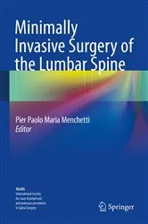Book cover of Minimally Invasive Surgery of the Lumbar Spine by Pier Paolo Maria Menchetti