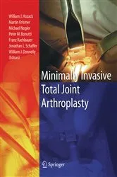 Book cover of Minimally Invasive Total Joint Arthroplasty by William J. Hozack