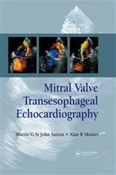 Book cover of Mitral Valve Transesophageal Echocardiography by Martin G. St. John Sutton