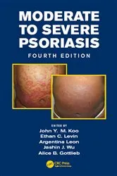 Book cover of Moderate to Severe Psoriasis (4th ed.) by John Koo