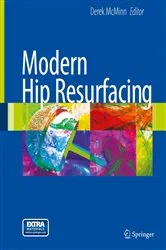 Book cover of Modern Hip Resurfacing by Derek J. W. McMinn