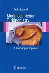 Book cover of Modified Inferior Turbinoplasty by Paolo Gottarelli