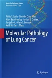 Book cover of Molecular Pathology of Lung Cancer by Philip T. Cagle
