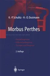 Book cover of Morbus Perthes (2nd ed.) by Klaus-Peter Schulitz